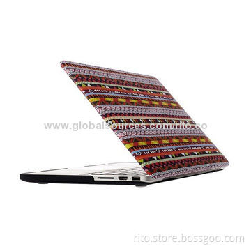 New Strip Pattern Design Rubberized Hard Case for Macbook Pro 15-inch Retina